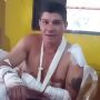 Motociclista que atropelou jaguatirica tentou sair por cima em vídeo: "Fui atacado"