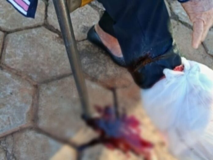 Idosa fica ferida ao ser atacada por cachorro do vizinho em Nova Andradina