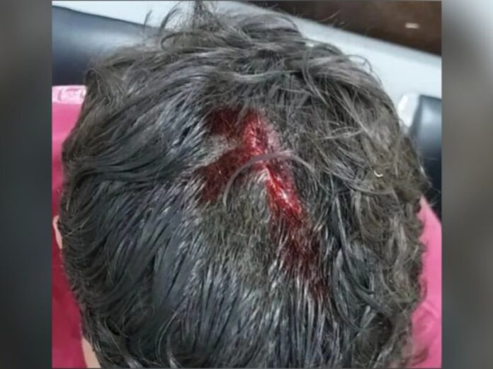 Jovem é ferido com cinco tiros e adolescente é atingido em atentado em Sonora