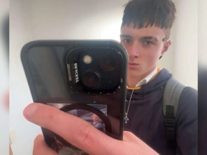 Vício em cigarro eletrônico faz adolescente perder pedaços do pulmão