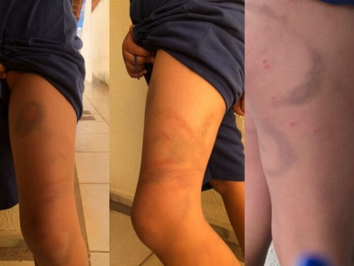 Criança é surrada pelo próprio pai; mãe busca proteção na Polícia Civil em Campo Grande